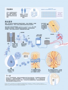 人口骨折率_腿骨折图片(2)