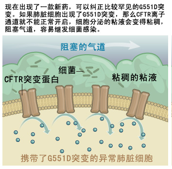 对抗囊性纤维化病致病突变的新药| 生命奥秘