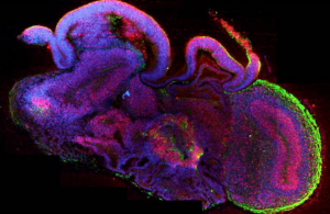 Organoids1