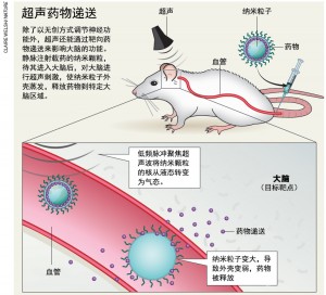 超声药物递送