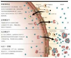 修复核转运