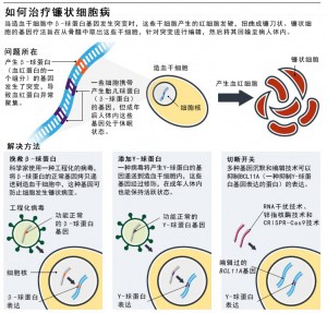 如何治疗镰状细胞病