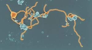 复杂生命体的起源——神秘微生物