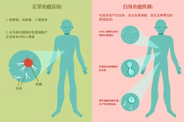 解密自身免疫疾病II | 热点 | 生命奥秘