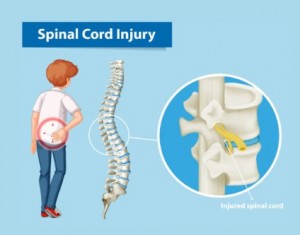 Spinal Cord Injury2