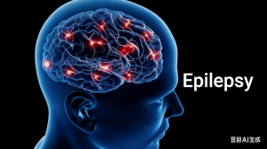 Epilepsy-2