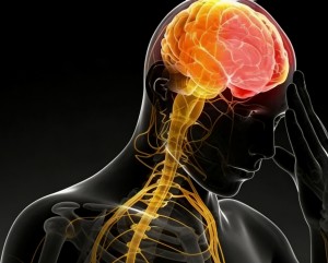 无症状性脑梗死